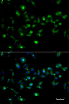 Western blot analysis of extracts of various cell lines using Acetyl-Histone H3-K56 Polyclonal Antibody at dilution of 1:1000.