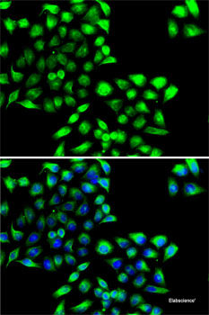 Western blot analysis of extracts of various cell lines using Acetyl-Histone H3-K18 Polyclonal Antibody at dilution of 1:1000.