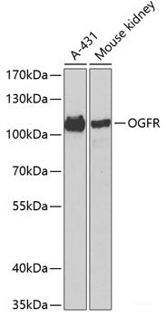 Western blot analysis of extracts of various cell lines using Acetyl-Histone H4-K8 Polyclonal Antibody at dilution of 1:1000.