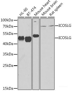 Immunofluorescence analysis of HeLa cells using TriMethyl-Histone H3-K56 Polyclonal Antibody at dilution of  1:100 (40x lens). Blue: DAPI for nuclear staining.