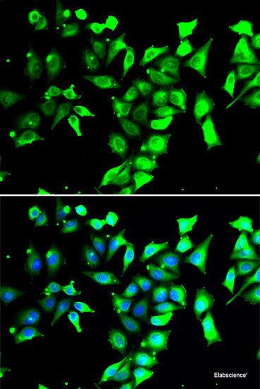 Immunohistochemistry of paraffin-embedded Rat brain using LMO4 Polyclonal Antibody at dilution of  1:100 (40x lens).