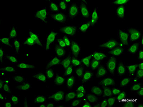 Immunofluorescence analysis of MCF-7 cells using ASPA Polyclonal Antibody