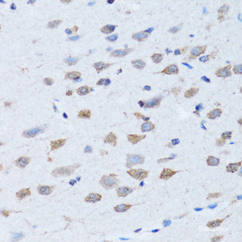 Western blot analysis of extracts of various cell lines using MCP-1 Polyclonal Antibody at dilution of 1:1000.