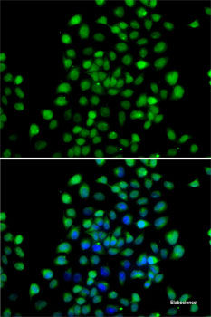 Immunofluorescence analysis of MCF-7 cells using GCM1 Polyclonal Antibody