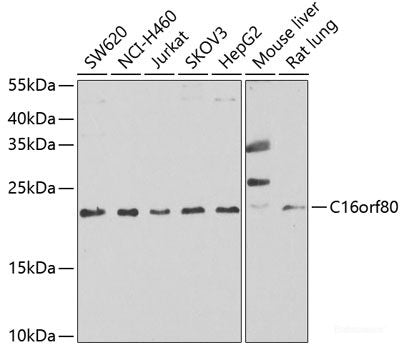 Western blot analysis of extracts of various cell lines using HDAC7 Polyclonal Antibody at dilution of 1:1000.