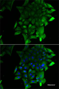 Immunofluorescence analysis of MCF-7 cells using IKZF3 Polyclonal Antibody
