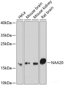 Western blot analysis of extracts of various cell lines using MID1 Polyclonal Antibody at dilution of 1:1000.