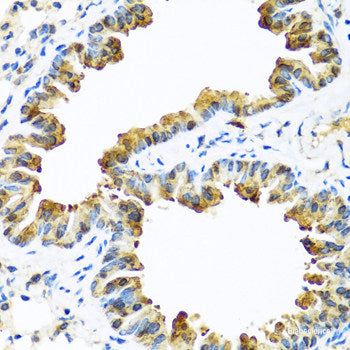Immunohistochemistry of paraffin-embedded Human colon using NCBP2 Polyclonal Antibody at dilution of  1:200 (40x lens).