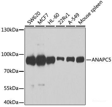 Immunofluorescence analysis of MCF-7 cells using PARP3 Polyclonal Antibody