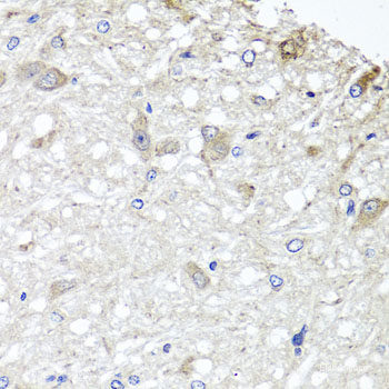 Immunofluorescence analysis of A-549 cells using POU6F1 Polyclonal Antibody