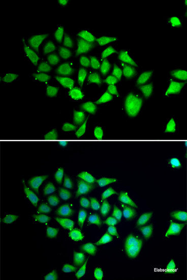 Immunohistochemistry of paraffin-embedded Human stomach using PRKAG1 Polyclonal Antibody at dilution of  1:100 (40x lens).