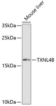Immunofluorescence analysis of MCF-7 cells using RNF7 Polyclonal Antibody