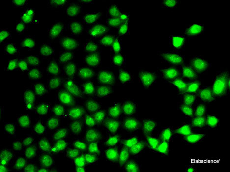Western blot analysis of extracts of MCF-7 cells using SETD5 Polyclonal Antibody at dilution of 1:300.
