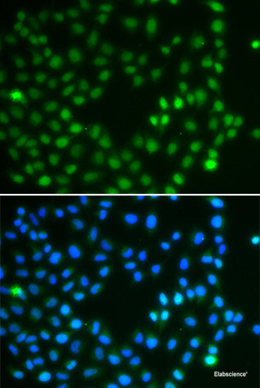 Immunofluorescence analysis of A-549 cells using SMYD3 Polyclonal Antibody