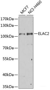 Immunofluorescence analysis of MCF-7 cells using TMLHE Polyclonal Antibody