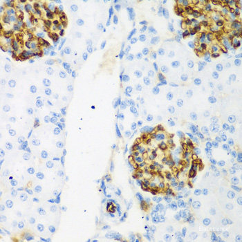 Immunofluorescence analysis of MCF-7 cells using TRIAP1 Polyclonal Antibody