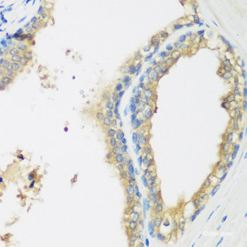 Immunohistochemistry of paraffin-embedded Rat spleen using WBSCR22 Polyclonal Antibody at dilution of  1:100 (40x lens).