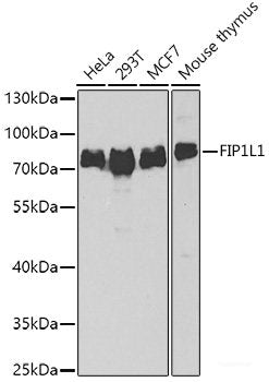 Immunofluorescence analysis of A-549 cells using YTHDC1 Polyclonal Antibody