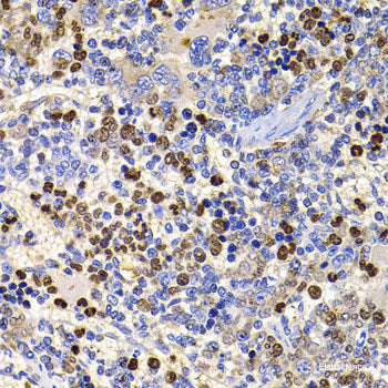 Immunohistochemistry of paraffin-embedded Rat kidney using BMP15 Polyclonal Antibody at dilution of  1:100 (40x lens).