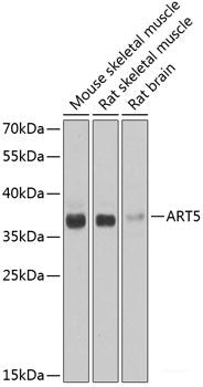 Western blot analysis of extracts from normal (control) and CAPG knockout (KO) HeLa cells using CAPG Polyclonal Antibody at dilution of 1:1000.