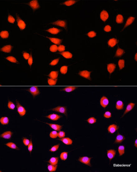 Immunofluorescence analysis of U-2 OS cells using ETS2 Polyclonal Antibody at dilution of  1:100. Blue: DAPI for nuclear staining.