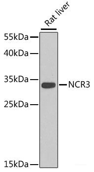 Immunofluorescence analysis of U-2 OS cells using PAX6 Polyclonal Antibody at dilution of  1:100. Blue: DAPI for nuclear staining.