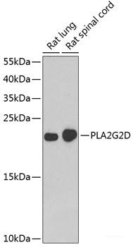 Western blot analysis of extracts of various cell lines using AMPKα2 Polyclonal Antibody at dilution of 1:1000.