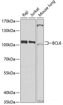 Immunohistochemistry of paraffin-embedded Human liver cancer using PTGS1 Polyclonal Antibody at dilution of  1:100 (40x lens).