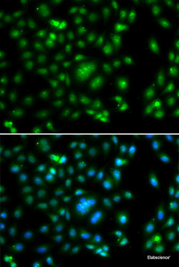 Western blot analysis of extracts of various cell lines using ZNF195 Polyclonal Antibody at dilution of 1:1000.