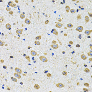 Immunofluorescence analysis of A549 cells using DPF1 Polyclonal Antibody
