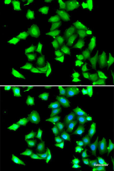 Immunohistochemistry of paraffin-embedded Human kidney using LZTR1 Polyclonal Antibody at dilution of  1:100 (40x lens).