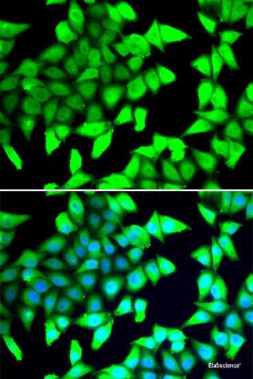 Immunohistochemistry of paraffin-embedded Rat brain using CIAO1 Polyclonal Antibody at dilution of  1:100 (40x lens).
