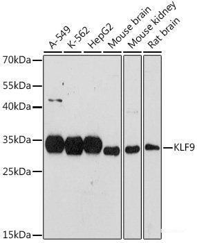 Immunohistochemistry of paraffin-embedded Human liver damage using CARD10 Polyclonal Antibody at dilution of  1:100 (40x lens).