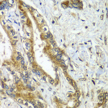 Immunohistochemistry of paraffin-embedded Mouse kidney using ERGIC2 Polyclonal Antibody at dilution of  1:100 (40x lens).