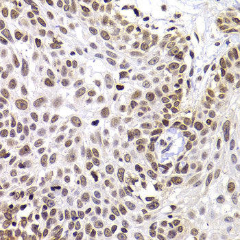 Immunofluorescence analysis of A549 cells using DCP1A Polyclonal Antibody