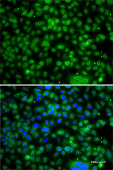 Immunohistochemistry of paraffin-embedded Human prostate using PPAN Polyclonal Antibody at dilution of  1:200 (40x lens).