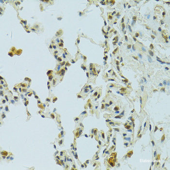 Immunohistochemistry of paraffin-embedded Rat brain using CAMK1G Polyclonal Antibody at dilution of  1:100 (40x lens).