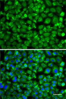 Immunohistochemistry of paraffin-embedded Human kidney using CSRP2BP Polyclonal Antibody at dilution of  1:100 (40x lens).