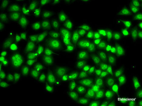 Immunohistochemistry of paraffin-embedded Mouse kidney using NLRC4 Polyclonal Antibody at dilution of  1:100 (40x lens).