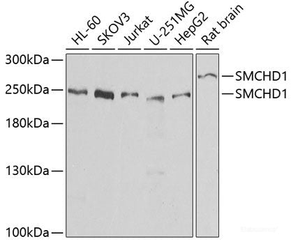 Immunohistochemistry of paraffin-embedded Rat brain using LGR6 Polyclonal Antibody at dilution of  1:100 (40x lens).