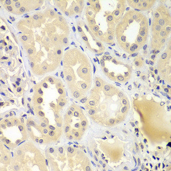 Western blot analysis of extracts of various cell lines using ACCS Polyclonal Antibody at dilution of 1:1000.