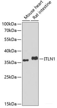 Immunohistochemistry of paraffin-embedded Human kidney using SPIN2B Polyclonal Antibody at dilution of  1:100 (40x lens).