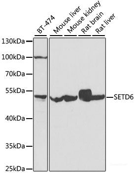 Western blot analysis of extracts of various cell lines using STIM1 Polyclonal Antibody at dilution of 1:1000.
