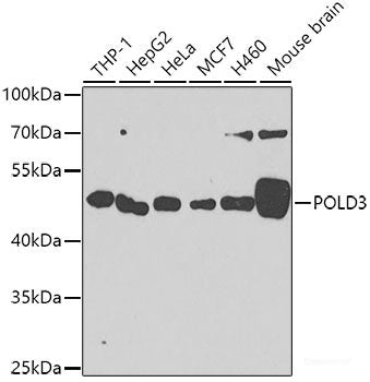 Western blot analysis of extracts of BxPC-3 cells using PNLIP Polyclonal Antibody at dilution of 1:1000.