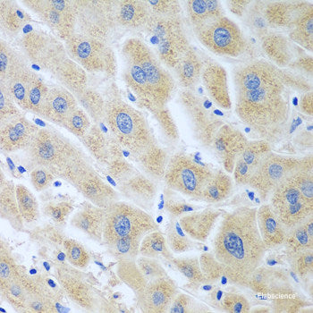 Immunohistochemistry of paraffin-embedded Rat kidney using NDUFV2 Polyclonal Antibody at dilution of  1:100 (40x lens).