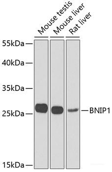 Immunohistochemistry of paraffin-embedded Rat kidney using OAZ1 Polyclonal Antibody at dilution of  1:100 (40x lens).