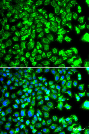 Immunohistochemistry of paraffin-embedded Human colon using TEAD3 Polyclonal Antibody at dilution of  1:100 (40x lens).