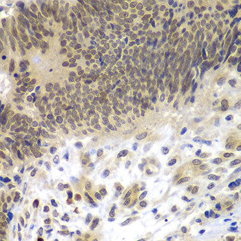 Immunohistochemistry of paraffin-embedded Rat brain using DAAM2 Polyclonal Antibody at dilution of  1:100 (40x lens).
