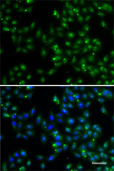 Immunofluorescence analysis of A549 cells using FBXO7 Polyclonal Antibody