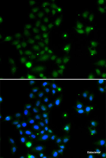 Western blot analysis of extracts of various cell lines using IL21R Polyclonal Antibody at dilution of 1:1000.